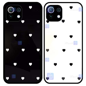 قاب فانتزی Xiaomi Mi 11 Lite مدل Heart