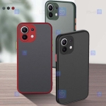 قاب گوشی شیائومی Mi 11 Lite مدل پشت مات محافظ لنزدار