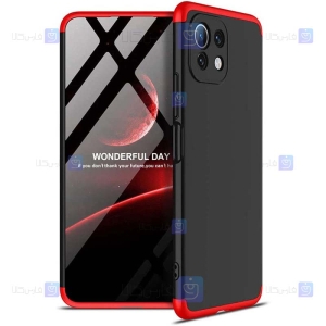 قاب 360 درجه Xiaomi Mi 11 Lite مدل GKK