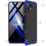 قاب 360 درجه Xiaomi Mi 11 Lite مدل GKK