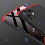 قاب 360 درجه Xiaomi Mi 11 Lite مدل GKK