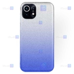 قاب ژله ای Xiaomi Mi 11 Lite مدل اکلیلی