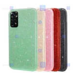قاب گوشی Xiaomi Redmi Note 11 4G مدل اکلیلی