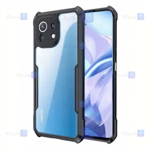 قاب ضد ضربه Xiaomi Mi 11 Lite مدل دور رنگی