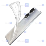 قاب ژله ای Honor 70