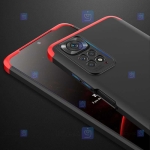 قاب 360 درجه Xiaomi Redmi Note 11S مدل GKK
