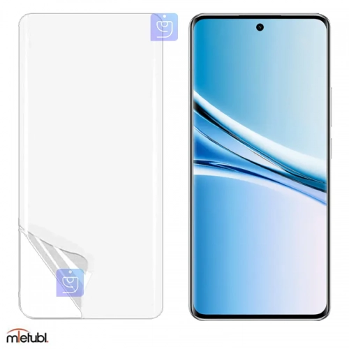 محافظ صفحه نمایش نانو هیدروژلی میتوبل گوشی شیائومی نوت 15 5G